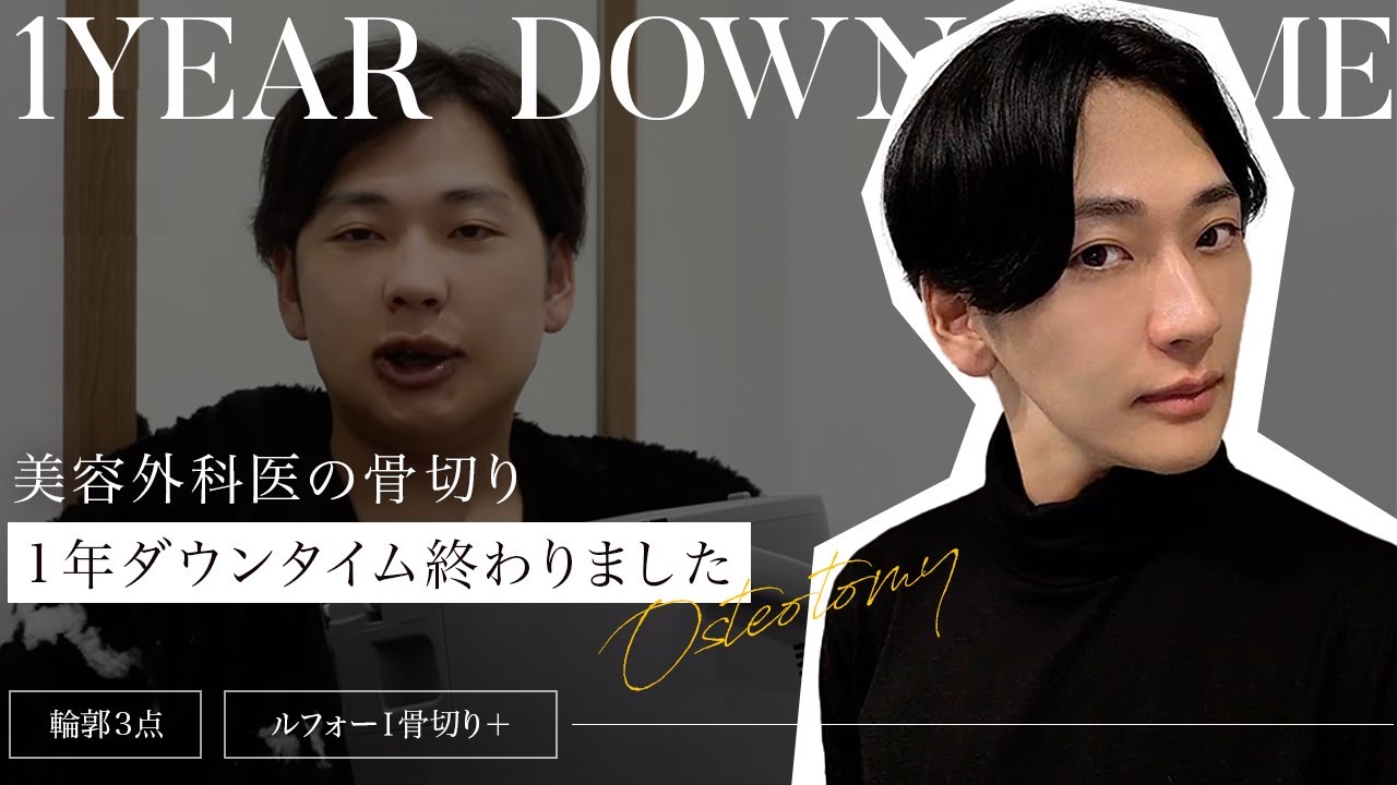 【美容整形】美容外科医が骨切り手術を受けて１年経ちました〜ダウンタイム記録〜【骨切り輪郭３点】