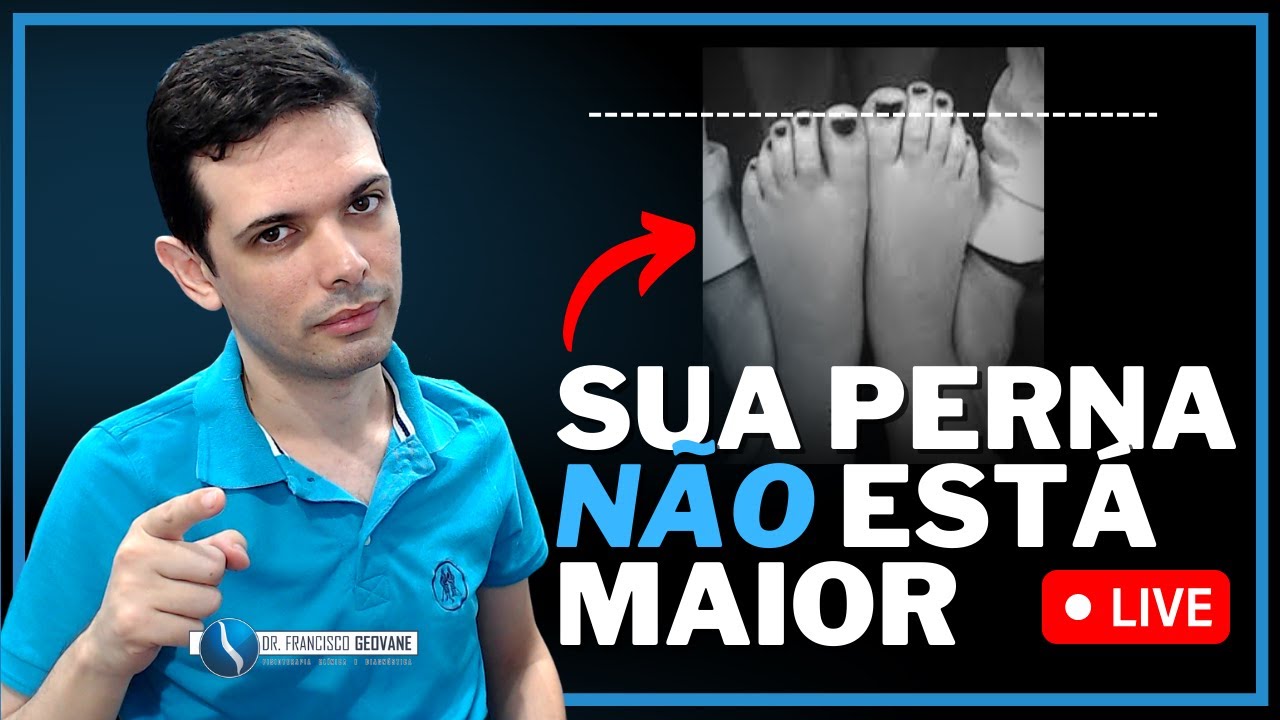 PERNA MAIOR QUE A OUTRA - Esse é o MAIOR ERRO que Muitos Profissionais cometem! (CUIDADO!! 🤚🛑)
