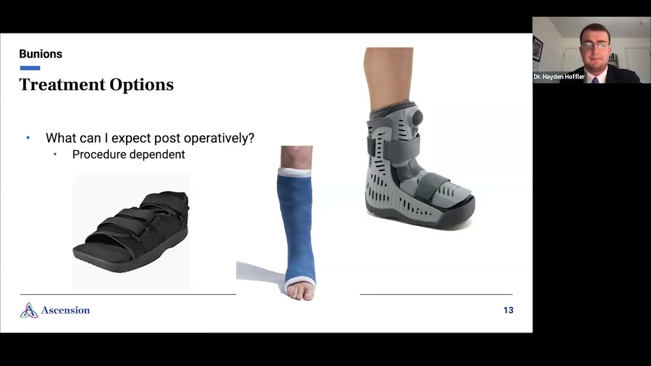 Ascension Saint Agnes Wellness Seminar Understanding Bunions and Hammertoes