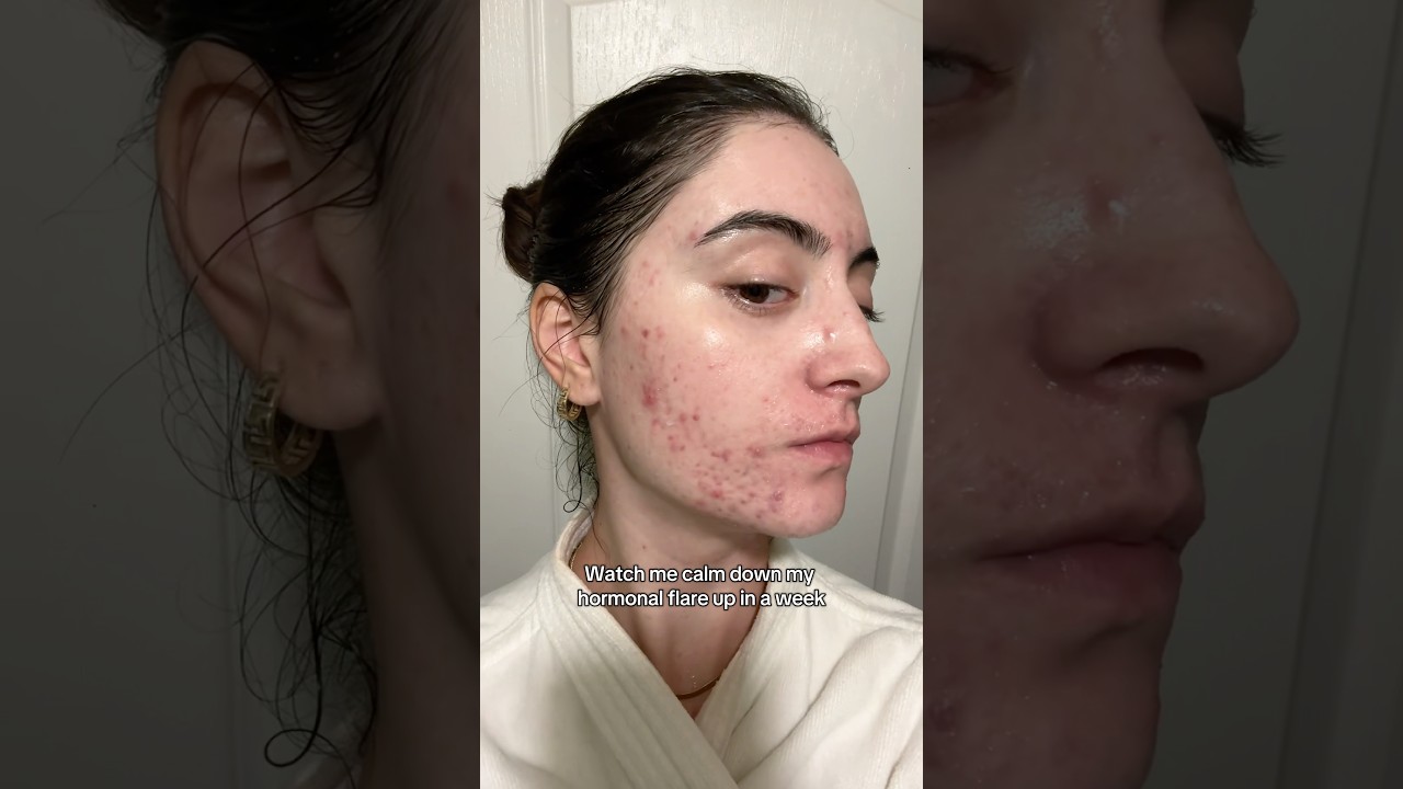 Посмотрите, как я успокаиваю свой гормональный всплеск за неделю 🥰✨ 