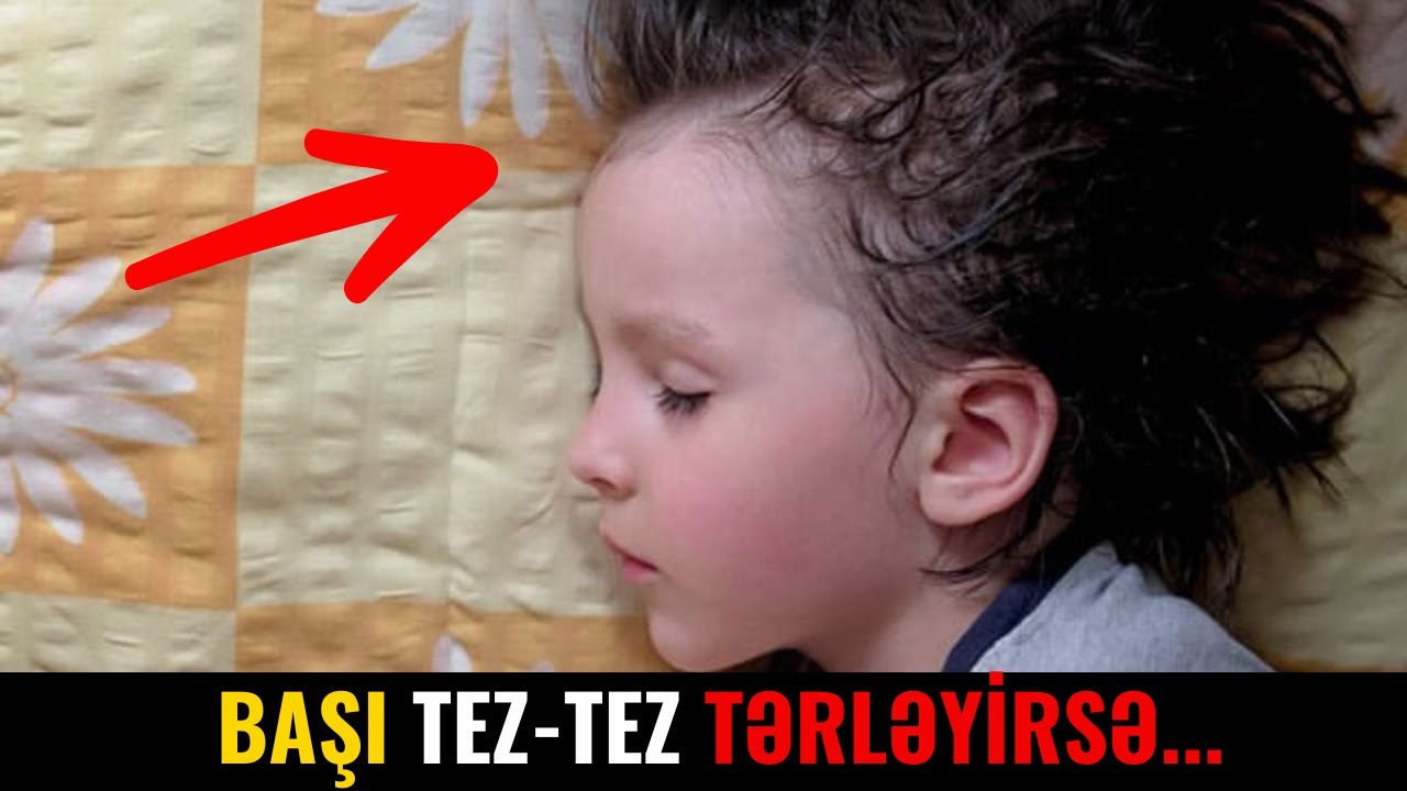 Uşağınızın başı çox tərləyirsə səbəbi...