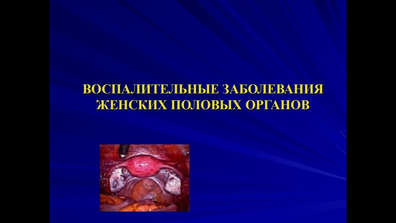 Լորձաթարախային արտադրություն հեշտոցից: Արդյո՞ք միշտ է դա վկայում սեռավարակի առկայության մասին:
