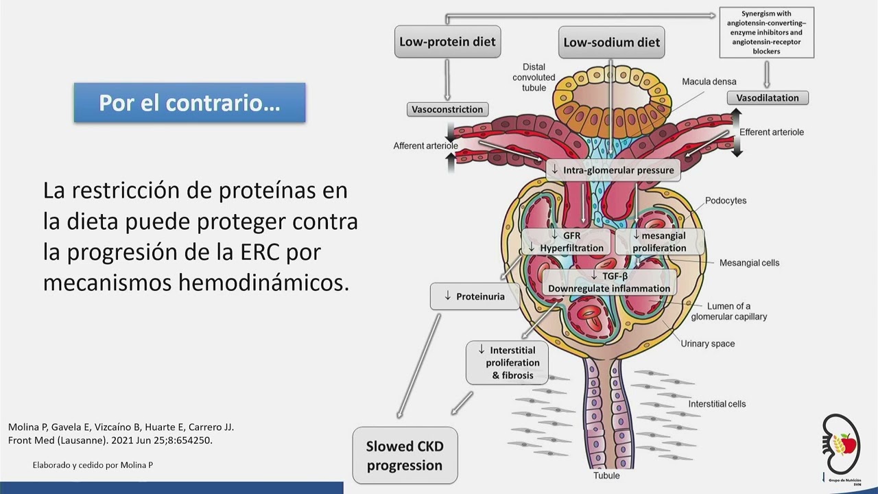 Manejo nutricional del paciente ERCA.
