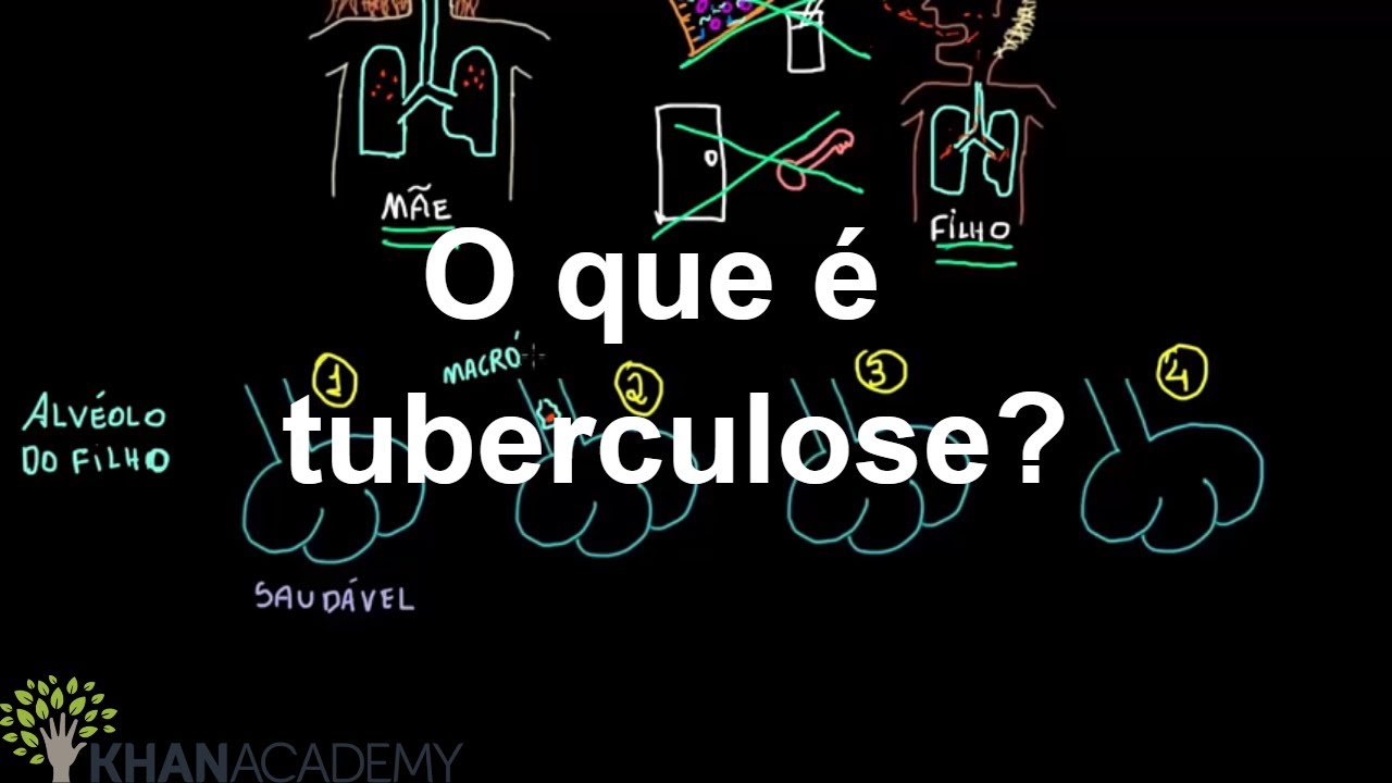 O que é tuberculose? | Quimica | Khan Academy