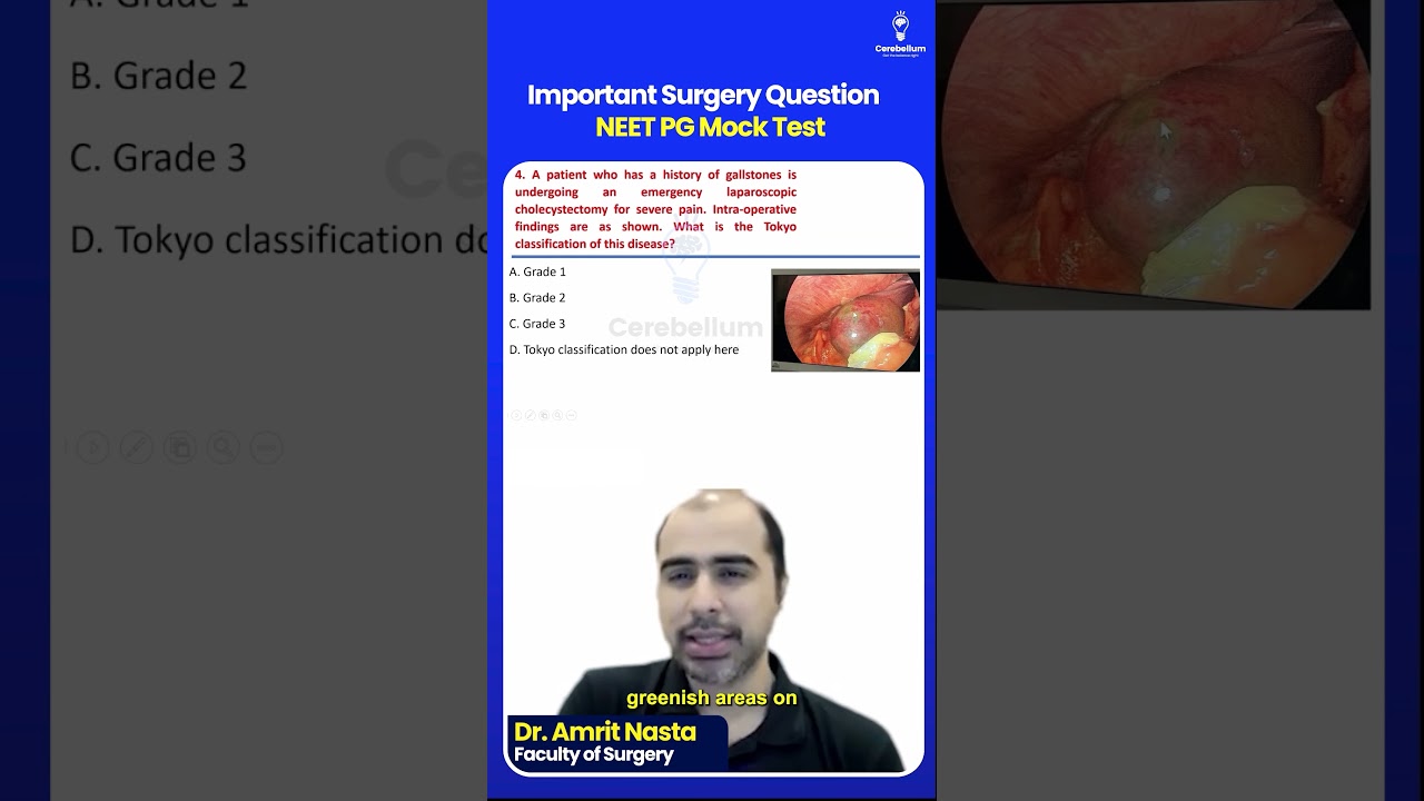 Important Surgery Question for NEET PG Mock Test | Dr. Amrit Nasta #shorts