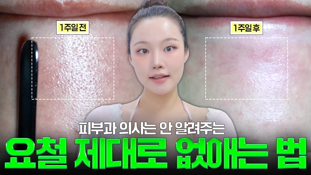 아직도 요철 많으세요..? 피부타입별 요철 없애는 실전 꿀팁, 루틴, 꿀조합 다 알려드릴게요