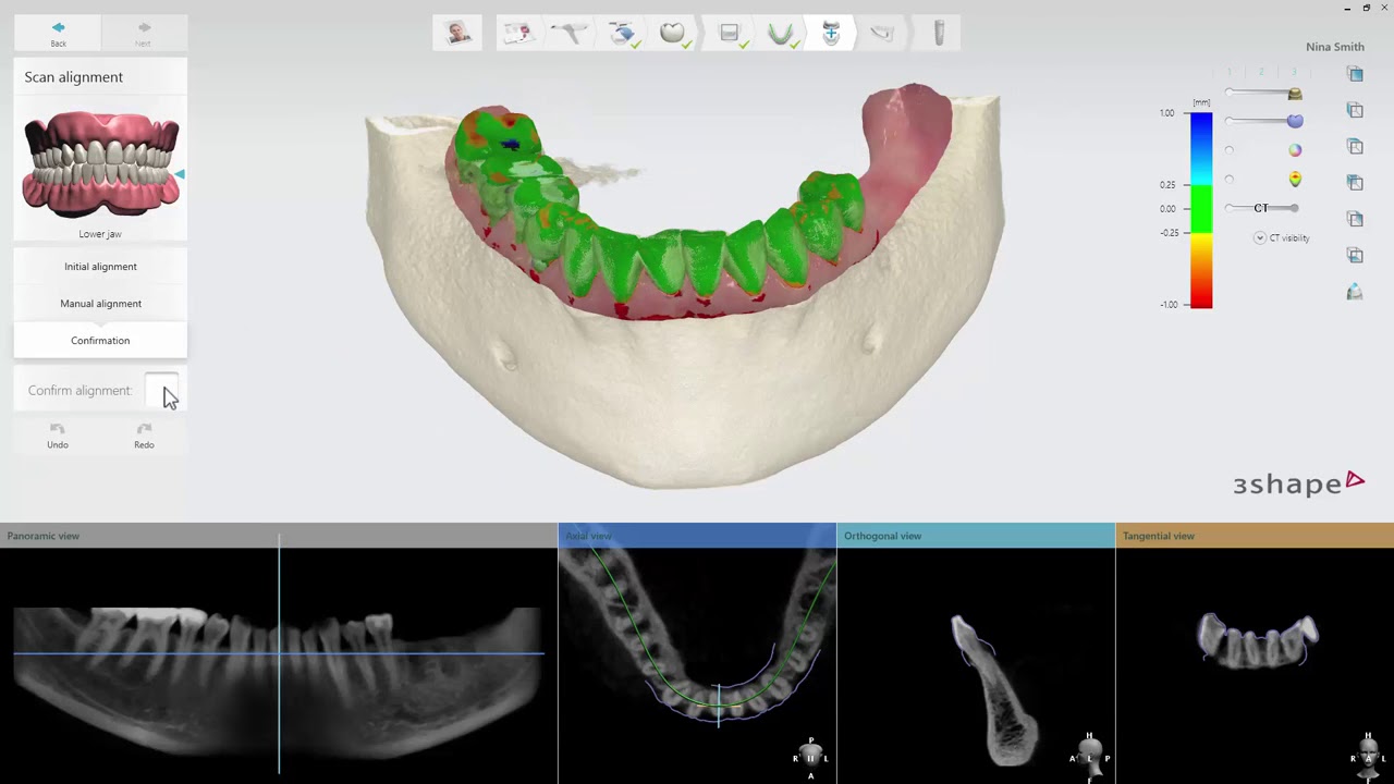 3DBioCAD - Implant Studio 2017  A demo