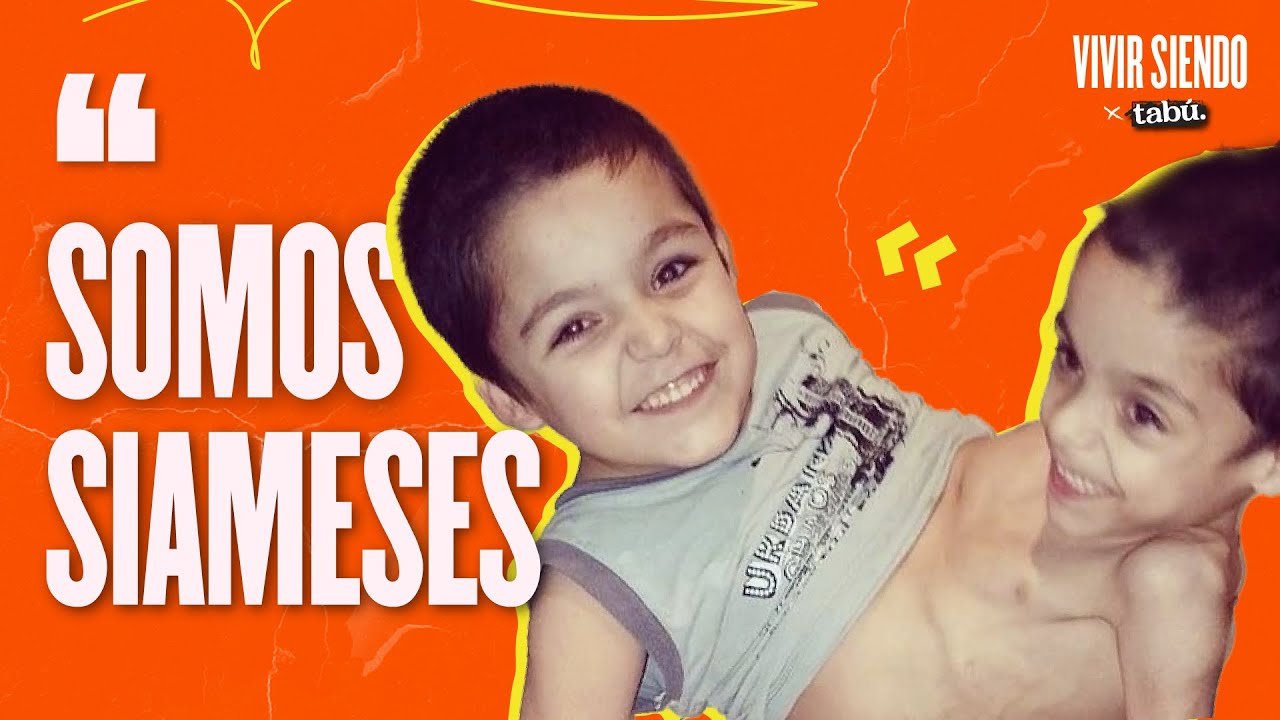 VIVIR SIENDO SIAMESES: dos personas en un mismo cuerpo (x@estoestabu)