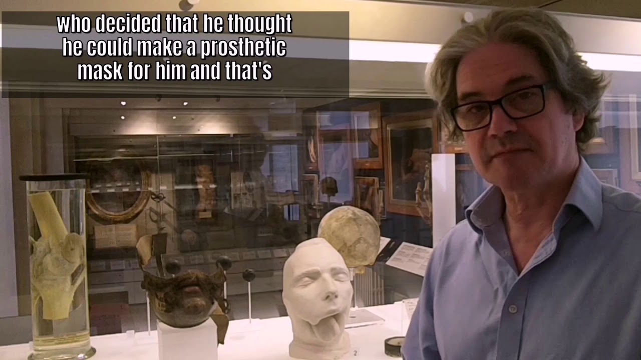 Tales from Surgeons' Hall: The mask of Alphonse Louis