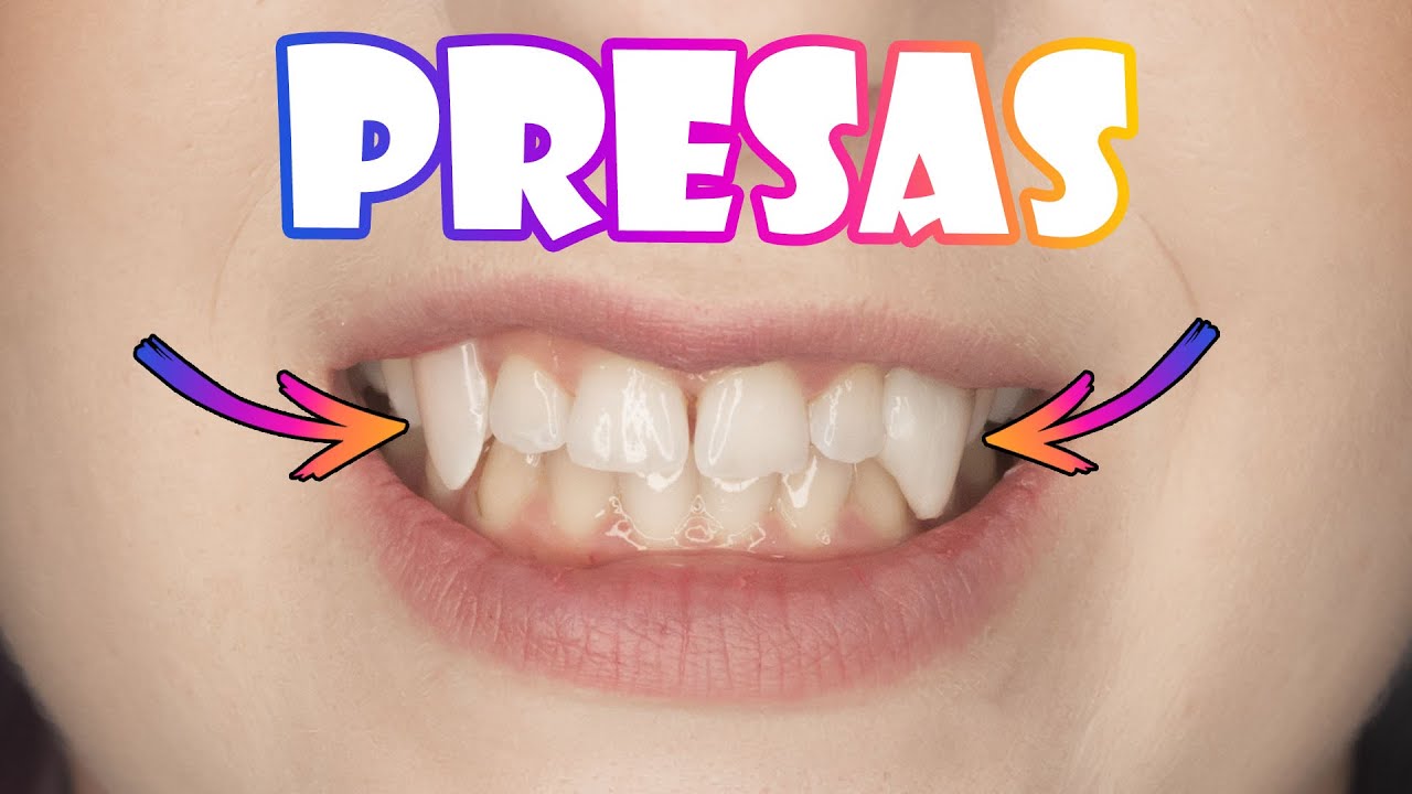 2 FORMAS de Fazer PRESAS para o seu COSPLAY - Dente Falso