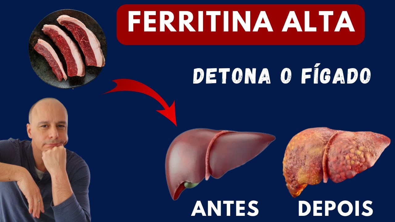 Ferritina Alta: Fígado DOENTE || Dr. Moacir Rosa