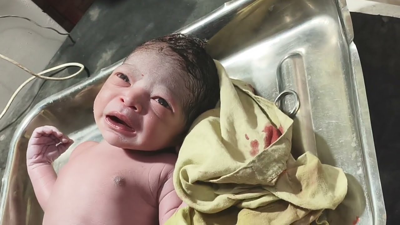 4 march 2025 ko The doctor had to struggle a lot in Sadar Hospital but a normal baby was born here