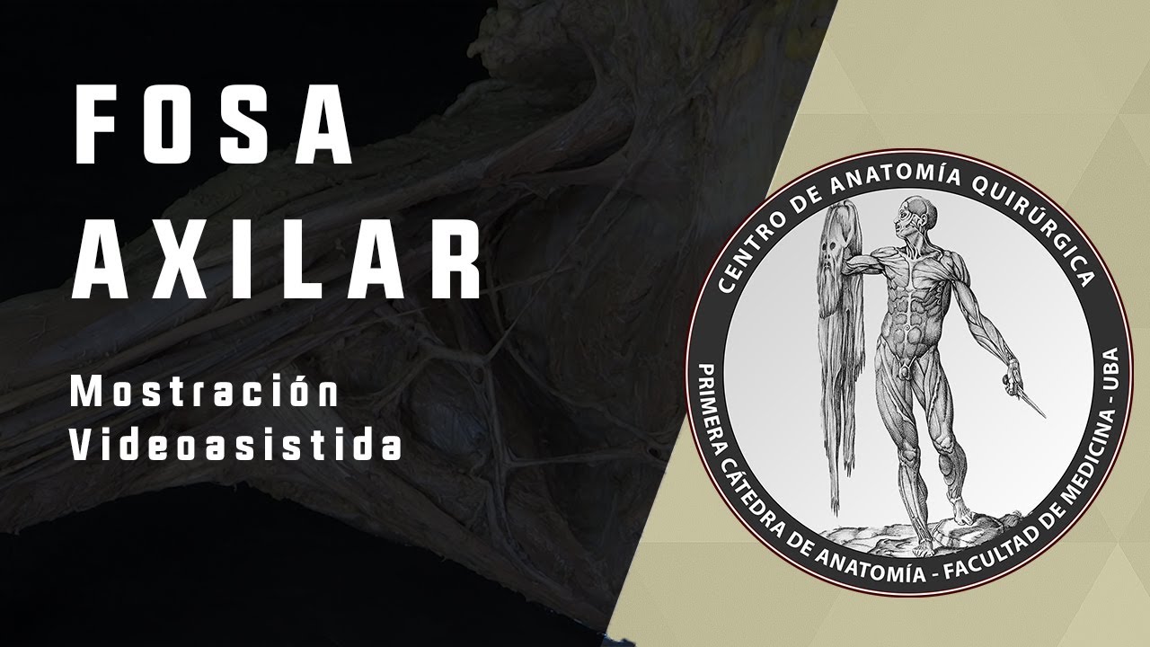 Fosa Axilar - Mostración Videoasistida