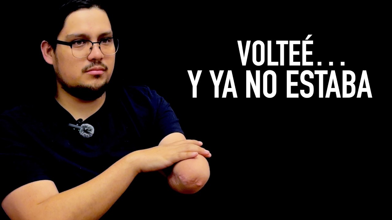 Perdí mi brazo… pero no mis ganas de vivir