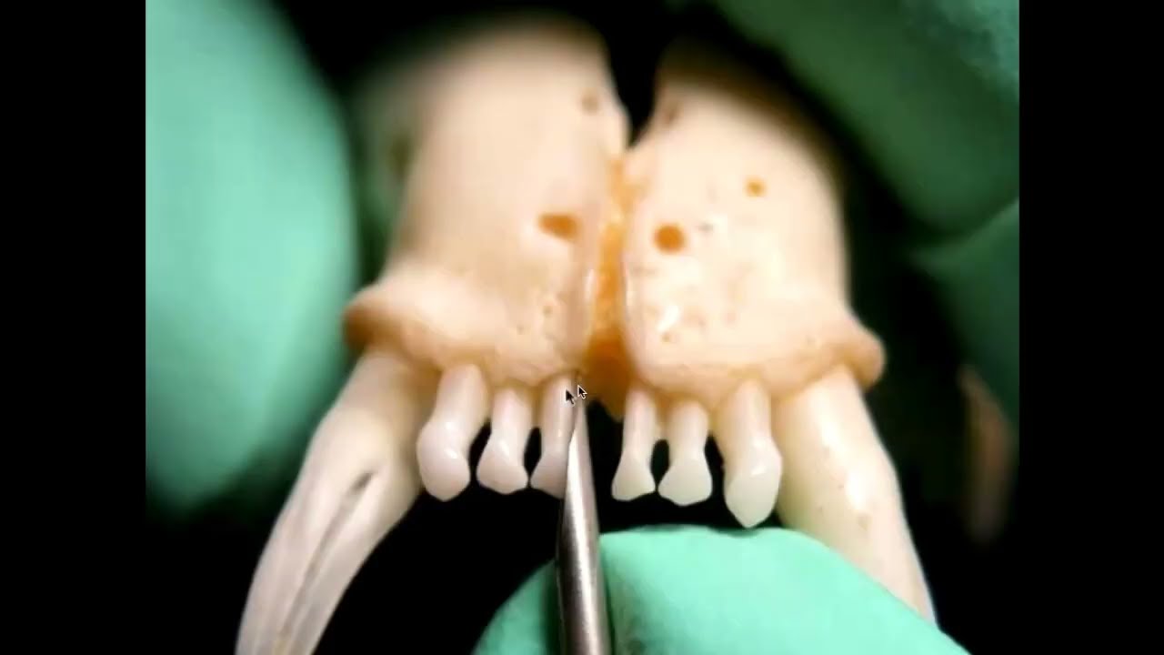 Extraction Techniques