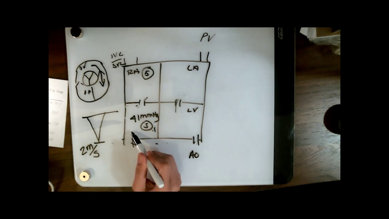 Noninvasive Conference 3.11.2021. Dr Wang