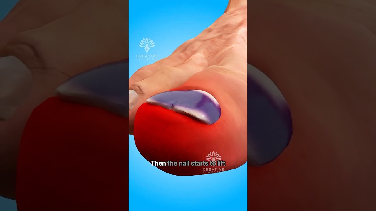 What Happens When Your Nail Falls Off😮 #short #viralvideo - Creativelearning3d