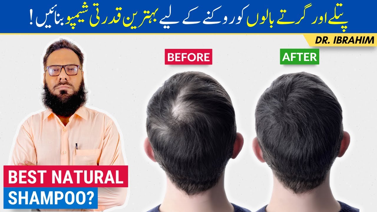 BEST Herbal Homemade Shampoo for Thinning Hair & Hair Fall | Balo Ke Liye Best Shampoo - Urdu/Hindi
