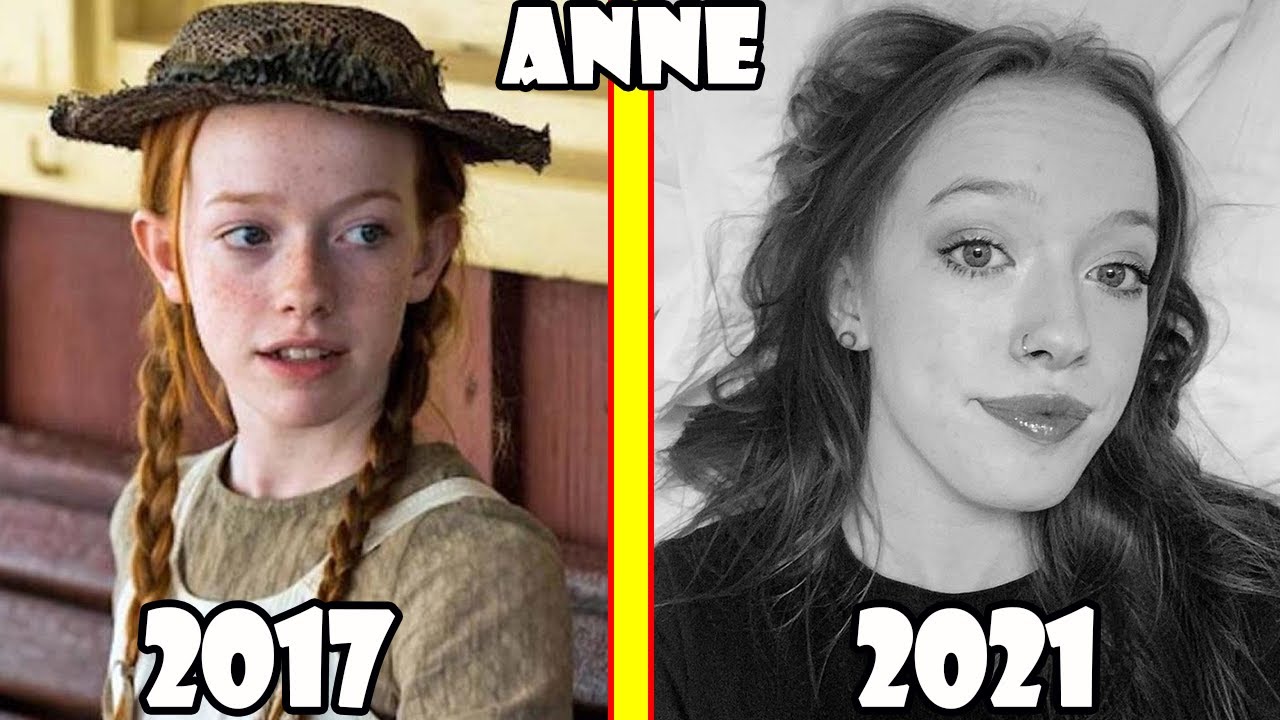 Anne With An E Before and After 2021 (Anne With An E Then and Now)