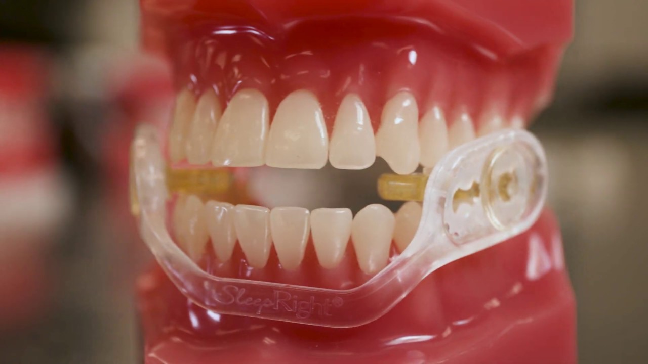 Which Dental Guard is the right fit?