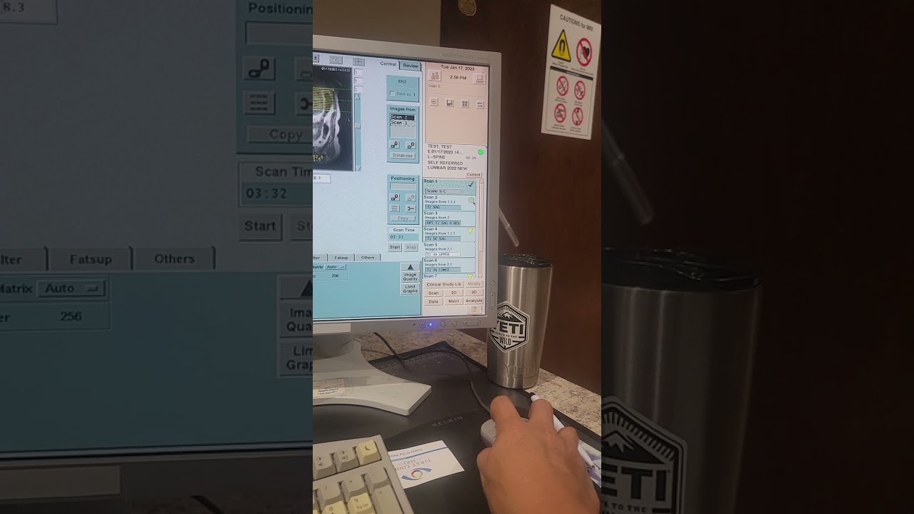 How to scan a lumbar spine on a Hitachi open MRI part 3