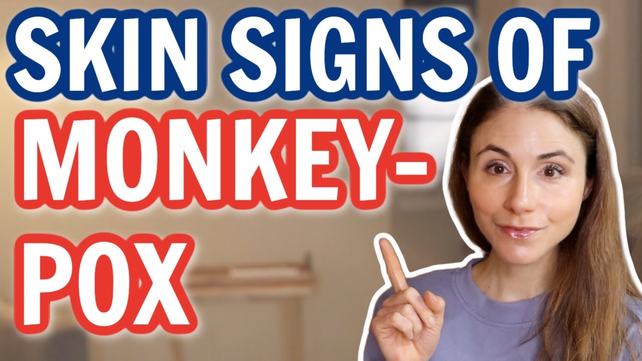 MONKEYPOX OUTBREAK 2022 SKIN SIGNS *UPDATE* DERMATOLOGIST @Dr Dray