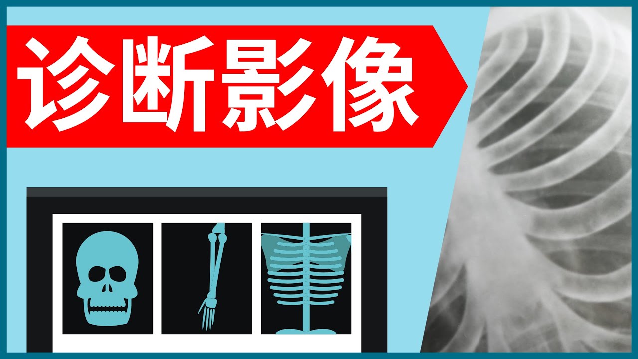 4种常见诊断影像有什么用? (X光 / CT扫描 / 超声波 / 核磁共振)
