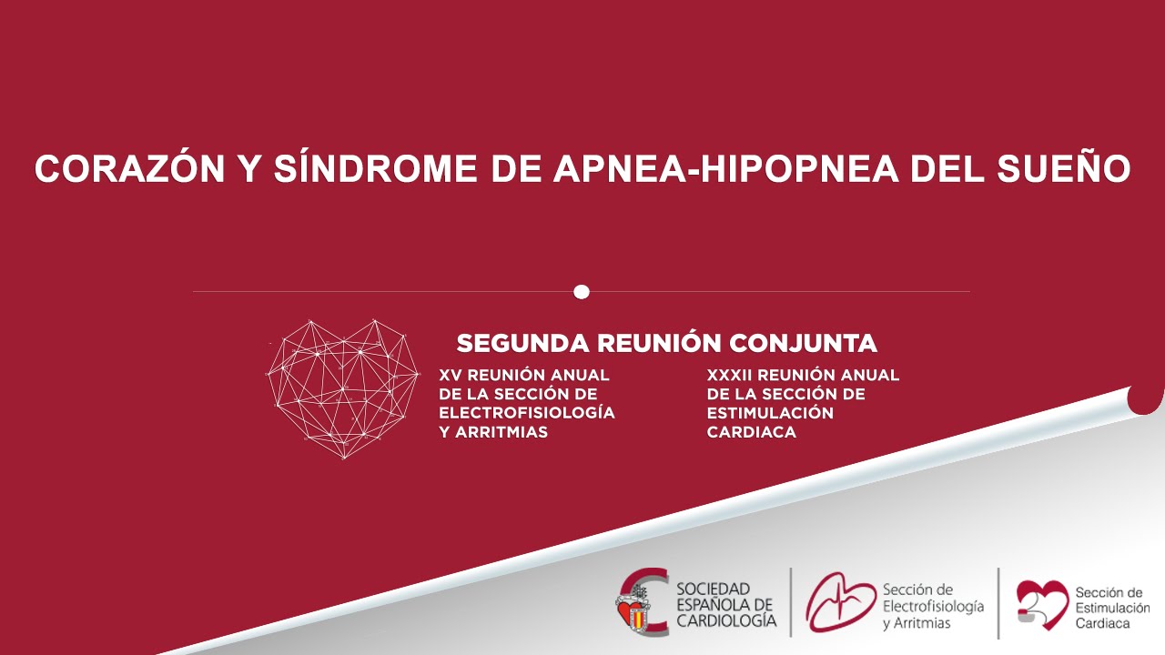 Corazón y síndrome de apnea-hipopnea del sueño