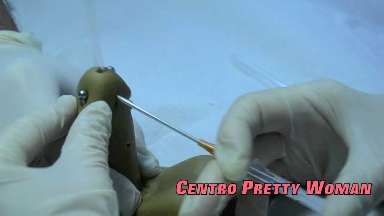 Piercing Pr&iacute;ncipe Alberto (Prince Albert Piercing)