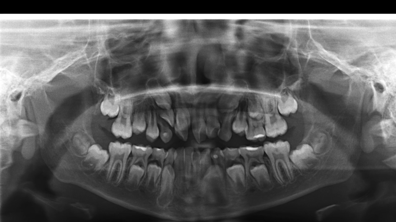 Radiografía Panoramica I
