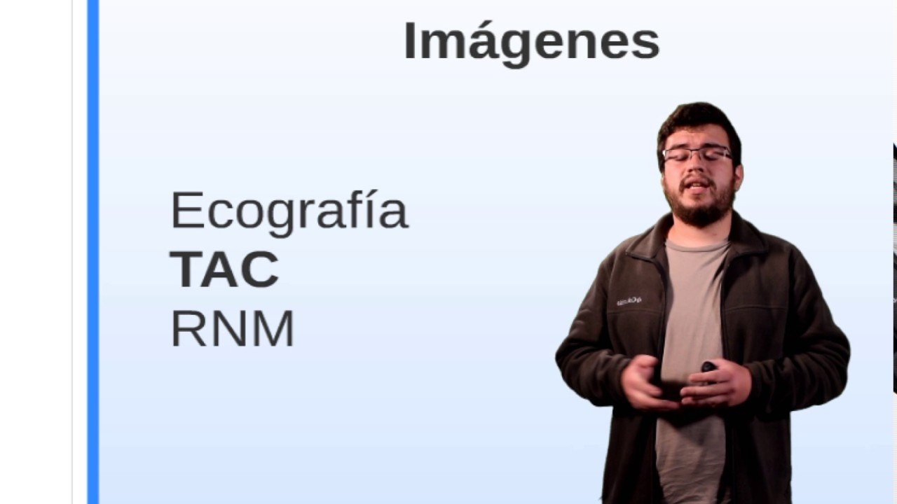 Pancreatitis Aguda