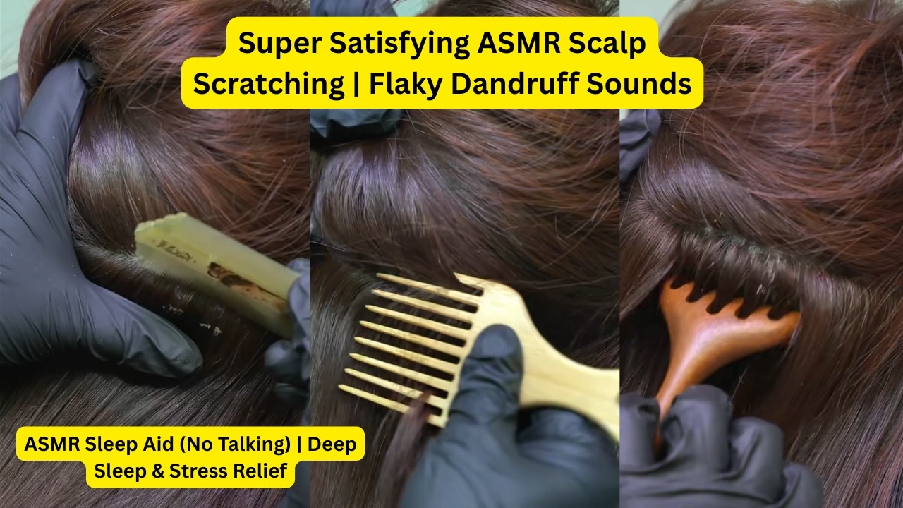 Super Satisfying ASMR Scalp Scratching | Flaky Dandruff Sounds  ⁨@ASMRAnnieYT   #30
