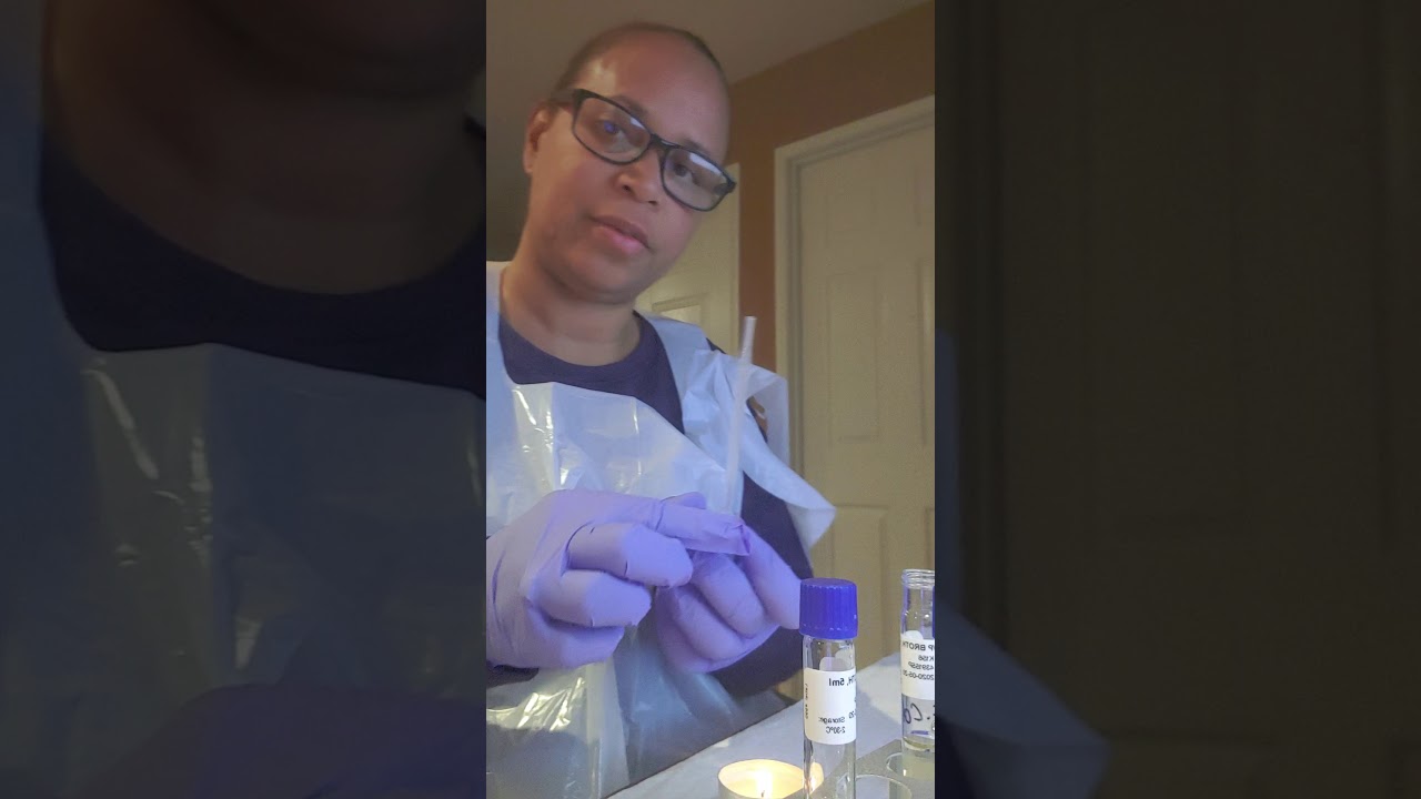 Biochemical testing for microbial identification.