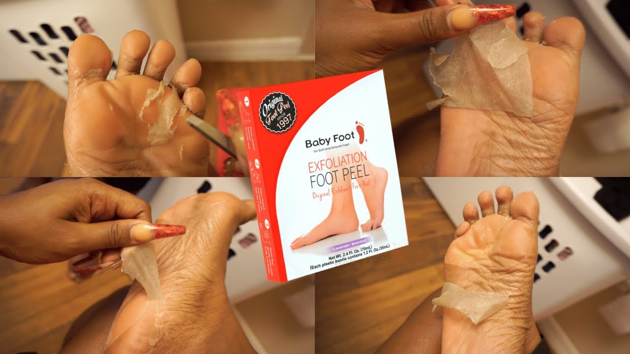 I Tried A Foot Peel Mask (Removing Dead Skin Extremely Satisfying)