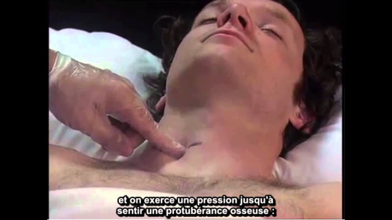 Comment : Réaliser un bloc du nerf du ganglion stellaire par guidage échographique