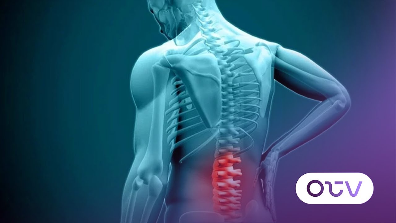 وجع الظهر... ديسك أم تكلس؟