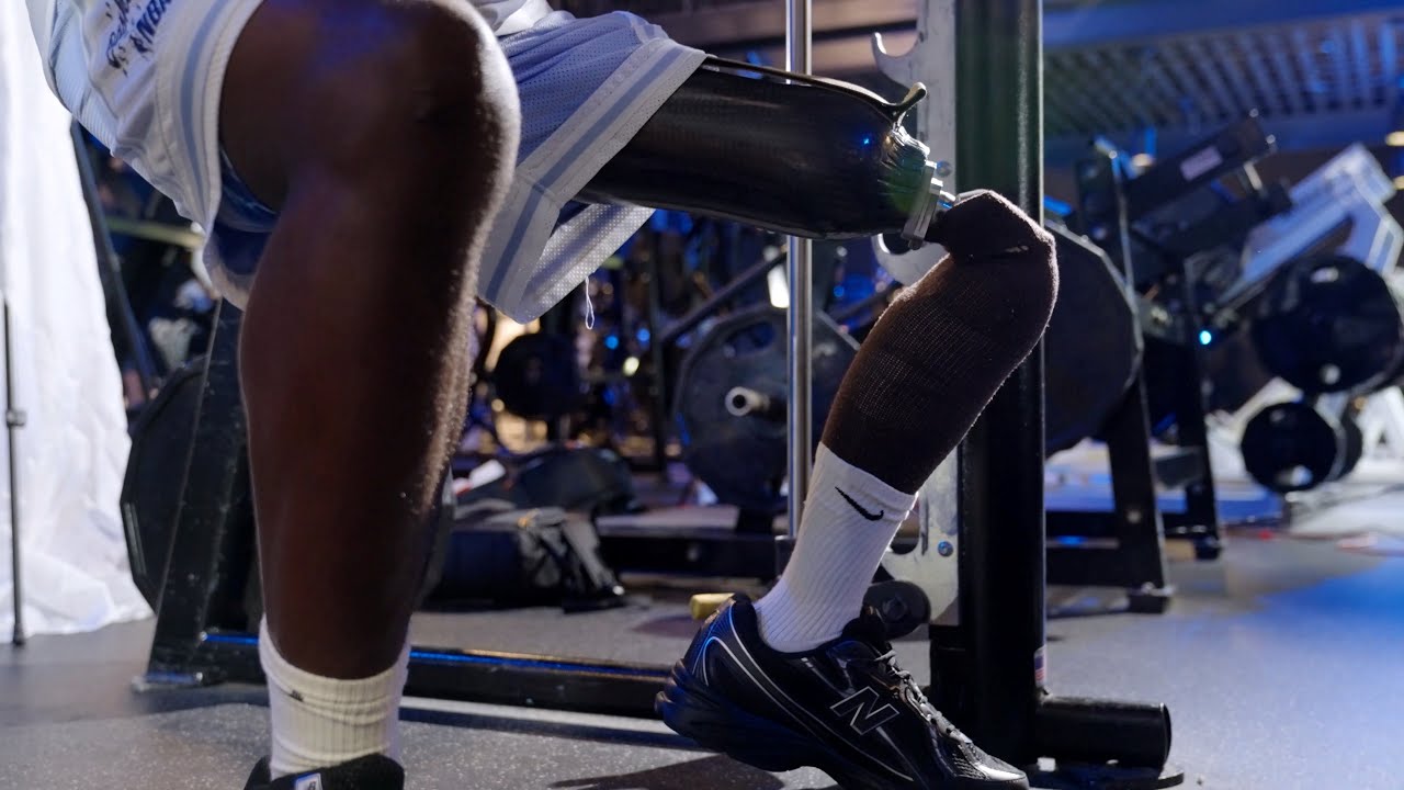 Types of Prosthetic Legs (Above Knee)