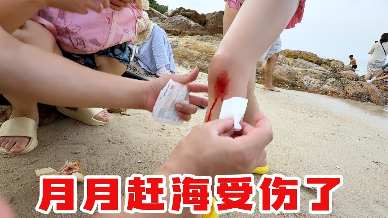 月月赶海受伤了，海边的礁石太硬了