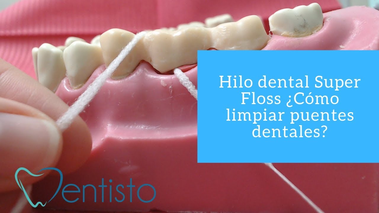 Hilo dental Super Floss ¿Cómo limpiar puentes dentales?