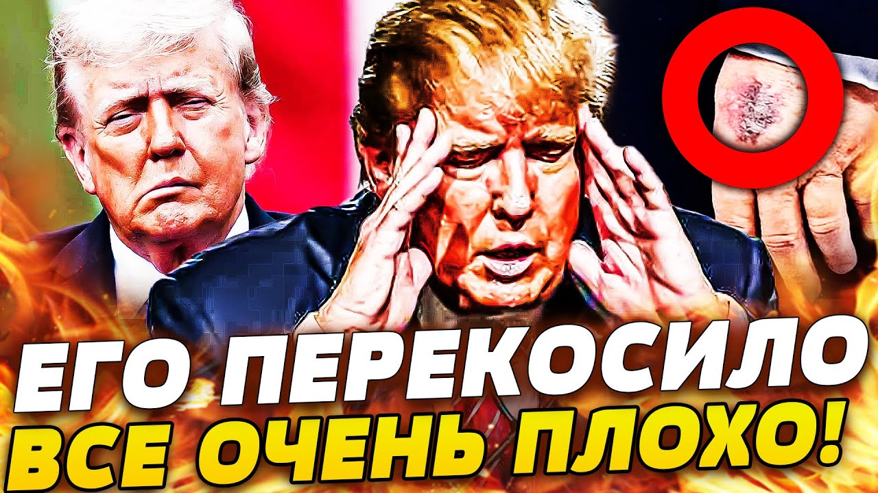 ‼️ТРАМПУ РЕЗКО СТАЛО ПЛОХО ПРИ ВСЕХ! СРОЧНОЕ СОВЕЩАНИЕ: ЕГО НЕ СПАСТИ!?