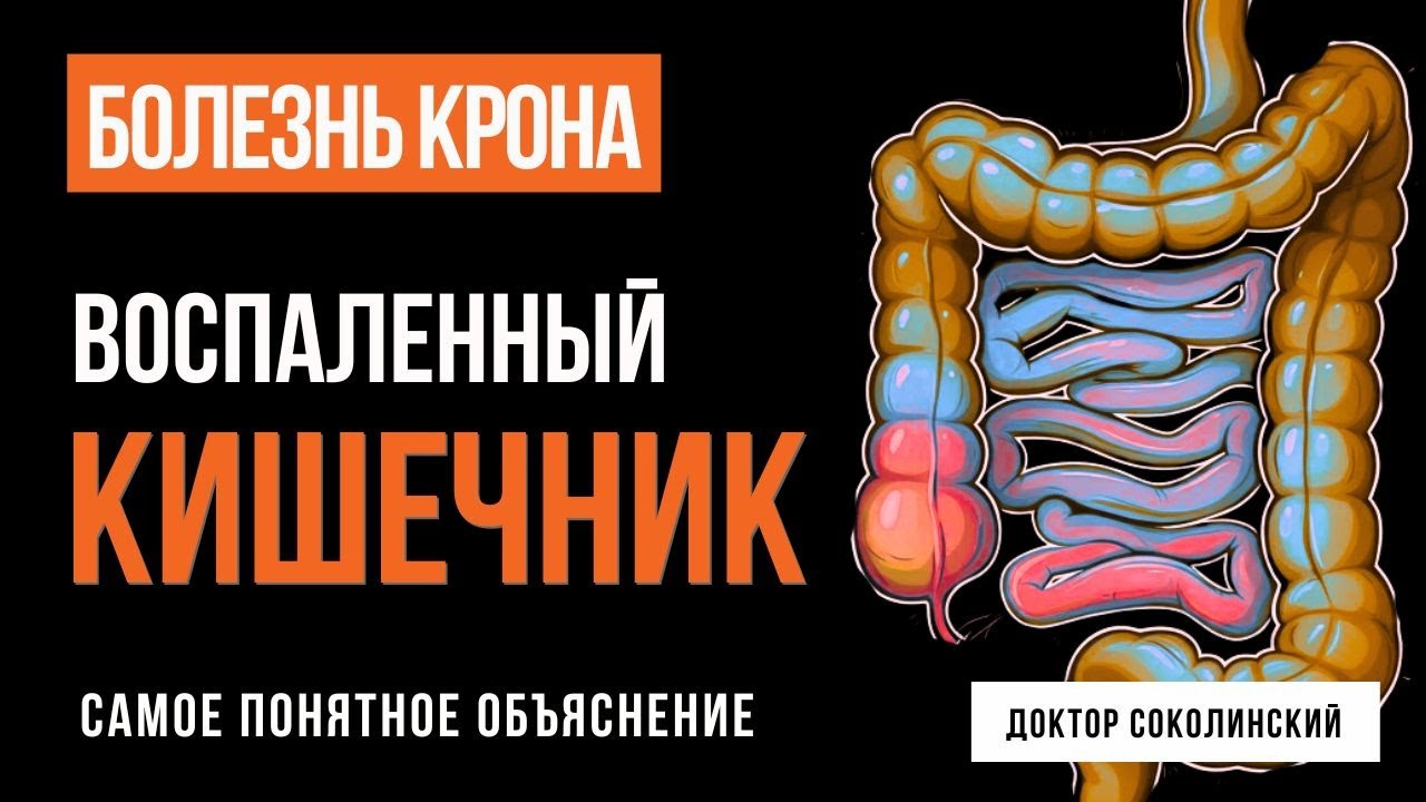 Болезнь Крона: почему кишечник воспаляется и как снизить риск обострений?