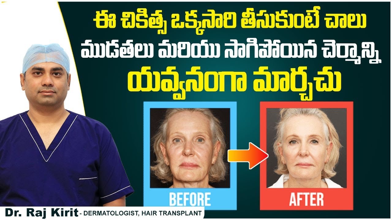 చర్మం టైట్ అవ్వాలంటే | Best Skin Treatment | Non Invasive Skin Tightening | Celestee Skin Clinic