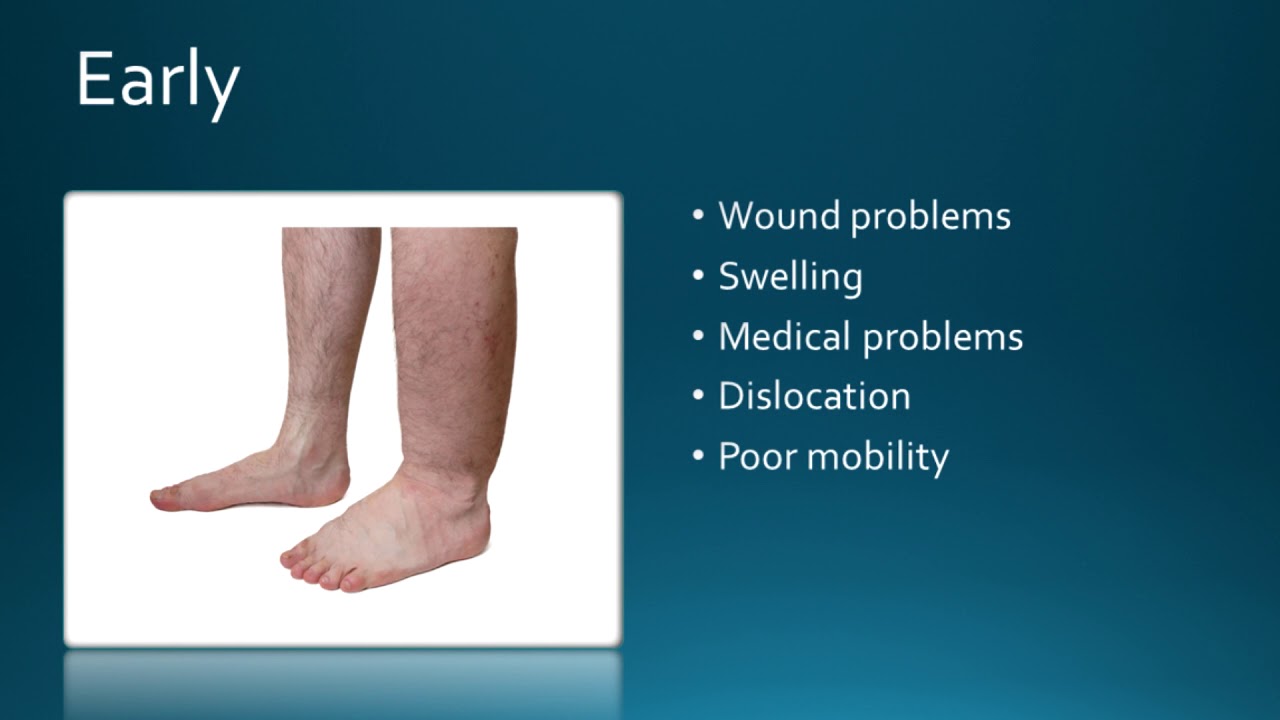 Complications after hip surgery