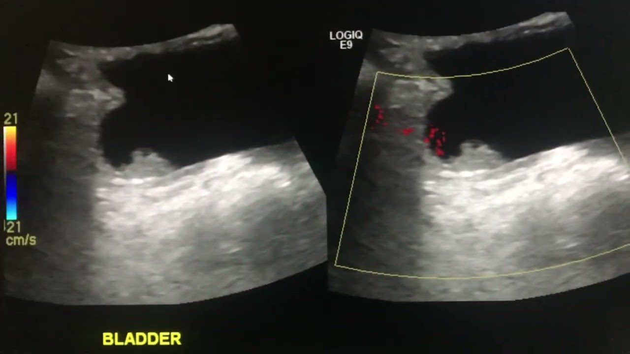 Interesting case No 47- US - UB MASS ( TCC)  &ndash; Radarchif