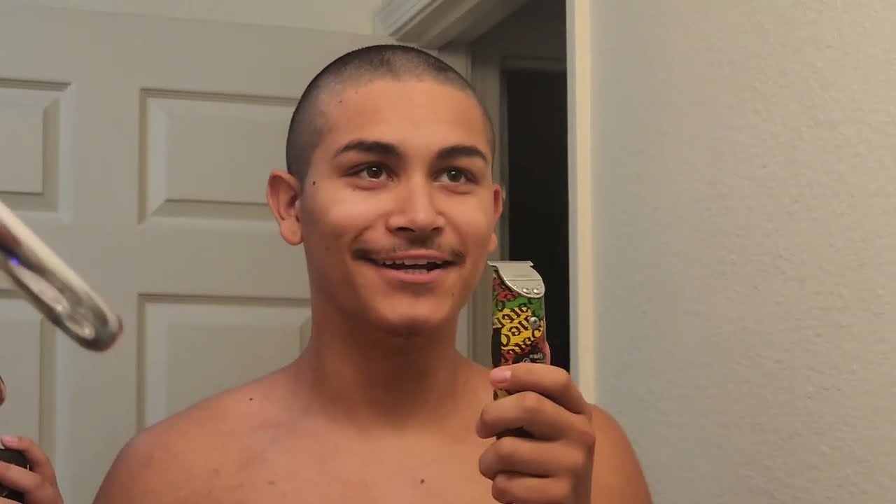 is he going bald?