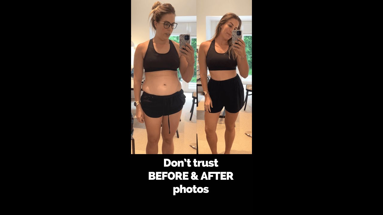 Don&rsquo;t trust weight loss BEFORE & AFTER photos 🤭 Nutritionist reveals sneaky diet industry tricks