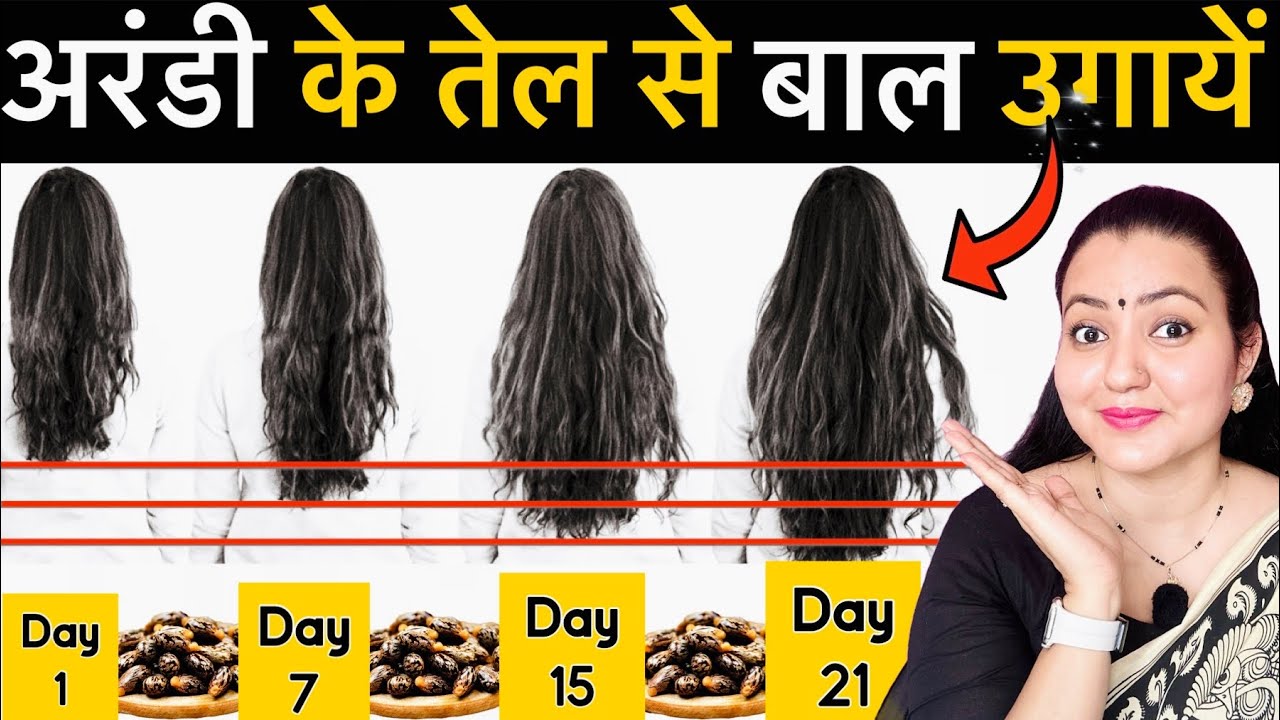 21 Days में *Castor Oil* से लम्बे बाल Grow करने  का Secret तरीका जो कोई नहीं बताएगा | 100% Results❤️