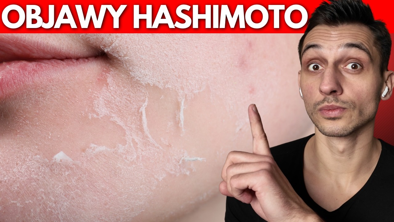 Dietetyk: kobiety bagatelizują te 3 typowe objawy Hashimoto!