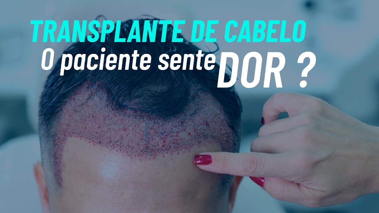Transplante de cabelo: Sedação Venosa x Sedação Oral  #mansurtransplantecapilar #transplantecapilar