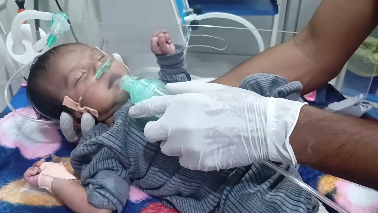 How To Nebulize To New Born baby 🐥 || Step By Step Guid For New Neonatologist #babycare 